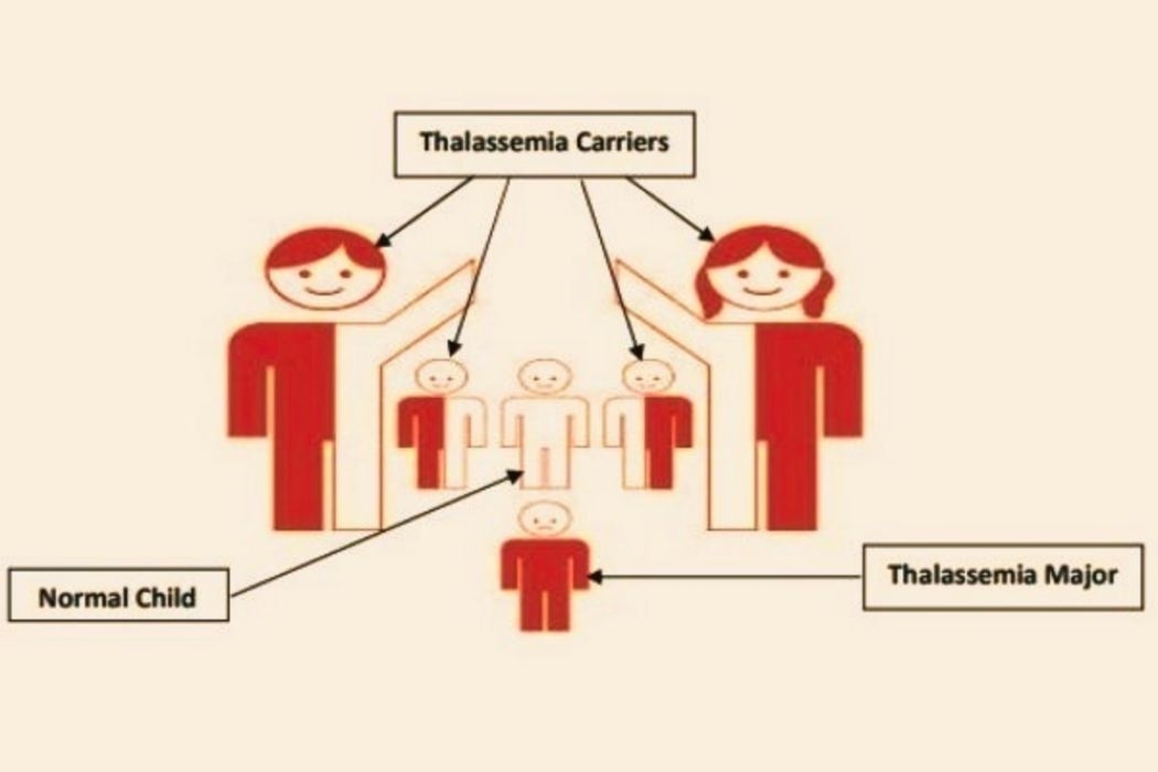 thalassemia